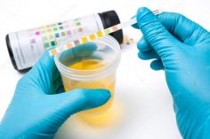 depositphotos_28330639-stock-photo-urine-test-strips