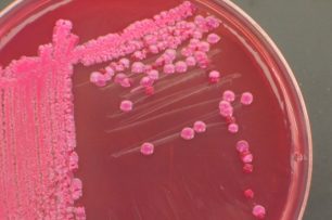 que-es-un-urocultivo-e1468333962817-640x425