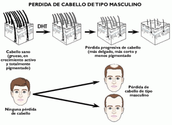 finasterida-1_tcm2374-310499