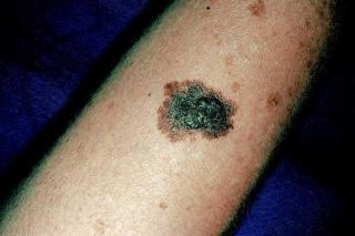 120039883v15n04-12003988fig03