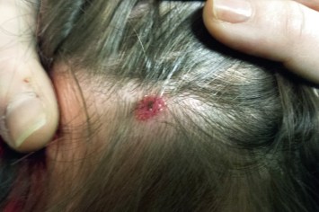 2016-n5-d_caso1_joseol_opt