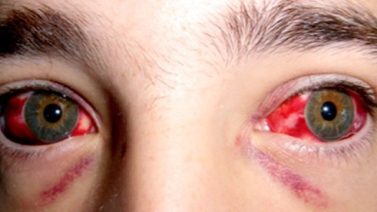 crimea-congo-640x360