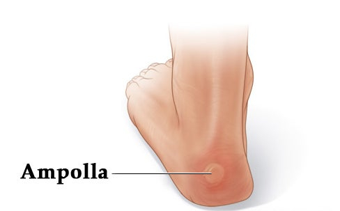 ampolla