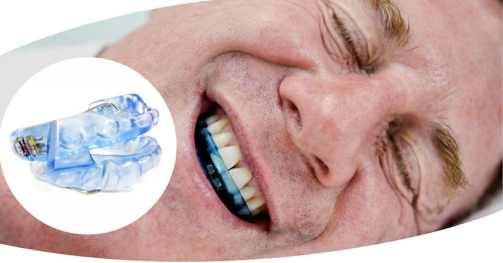 dispositivos-orales-tratamiento-apnea-de-suec3b1o-atmydisorders-15