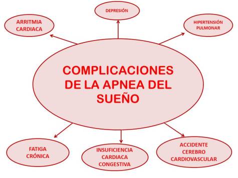 sintomas-apnea