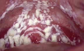 1lls-7roj3fsbbnyixwklw