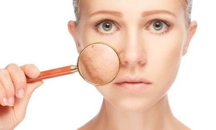 util-e-interesante-como-quitar-manchas-piel-n269217-696x418-352513